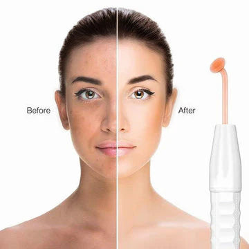 High Frequency Skin Therapy wand 4 in 1